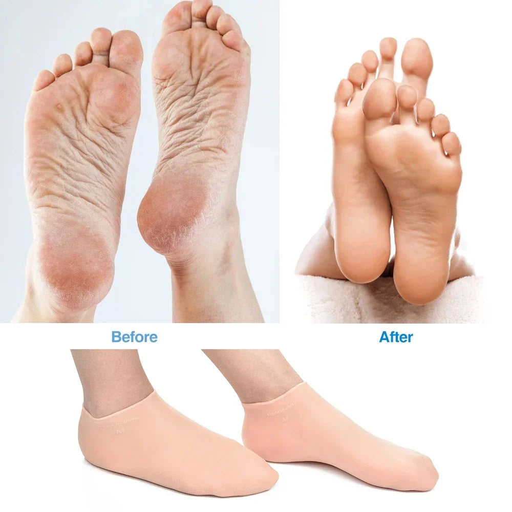 Water Sports Silicone Socks | Non-Slip Beach Protection