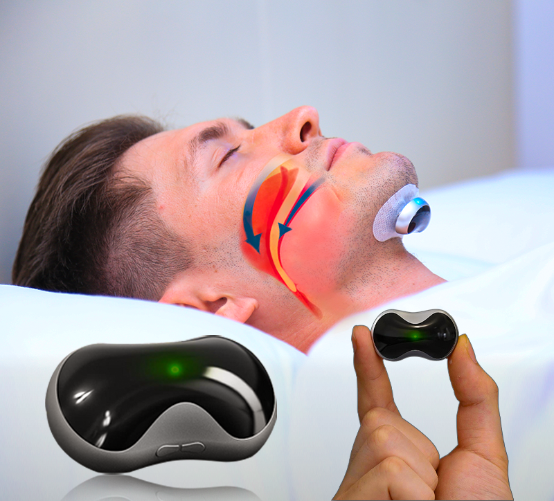 Anti Snoring Device | Smart Electrostimulation Technology